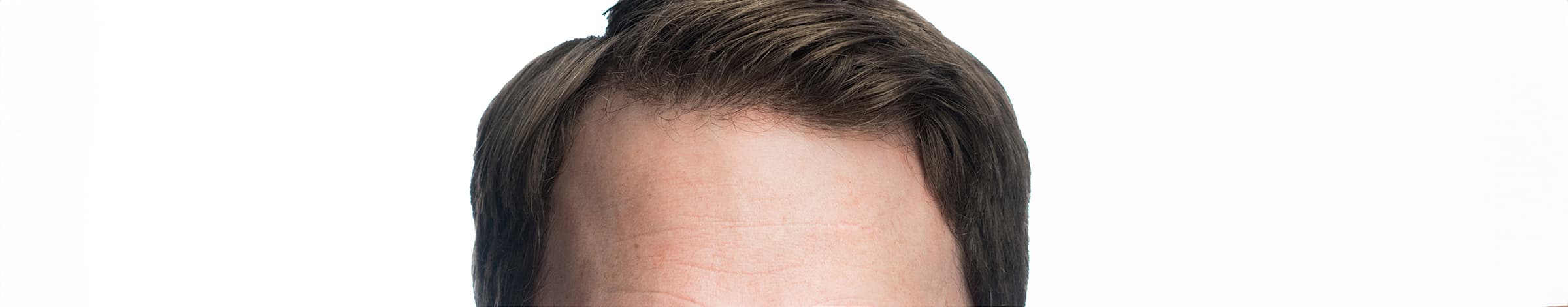 Forehead - Clear thinking and confidence